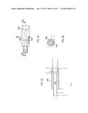 Methods of Self-Aligning Stent Grafts diagram and image