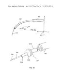 Methods of Self-Aligning Stent Grafts diagram and image