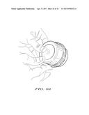 Methods of Self-Aligning Stent Grafts diagram and image