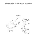 IMPLANT INSERTION DEVICE AND METHOD OF USE THEREOF diagram and image