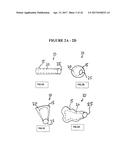 IMPLANT INSERTION DEVICE AND METHOD OF USE THEREOF diagram and image