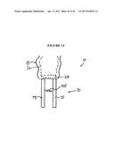 IMPLANT INSERTION DEVICE AND METHOD OF USE THEREOF diagram and image