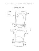 IMPLANT INSERTION DEVICE AND METHOD OF USE THEREOF diagram and image