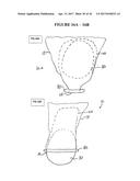 IMPLANT INSERTION DEVICE AND METHOD OF USE THEREOF diagram and image