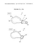 IMPLANT INSERTION DEVICE AND METHOD OF USE THEREOF diagram and image