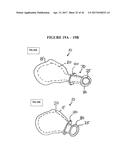 IMPLANT INSERTION DEVICE AND METHOD OF USE THEREOF diagram and image