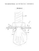 IMPLANT INSERTION DEVICE AND METHOD OF USE THEREOF diagram and image