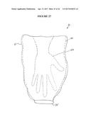 IMPLANT INSERTION DEVICE AND METHOD OF USE THEREOF diagram and image