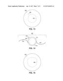 APPARATUS FOR CREATING INCISIONS TO IMPROVE INTRAOCULAR LENS PLACEMENT diagram and image