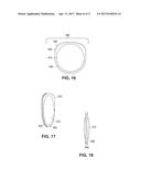 APPARATUS FOR CREATING INCISIONS TO IMPROVE INTRAOCULAR LENS PLACEMENT diagram and image