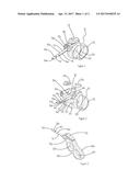 SURGICAL INTRODUCER diagram and image