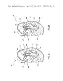 Heart Valves Prostheses and Methods for Percutaneous Heart Valve     Replacement diagram and image