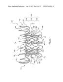 Heart Valves Prostheses and Methods for Percutaneous Heart Valve     Replacement diagram and image