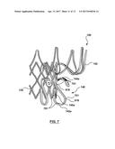 Heart Valves Prostheses and Methods for Percutaneous Heart Valve     Replacement diagram and image