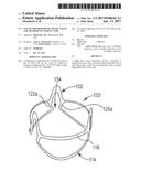 STENTS FOR PROSTHETIC HEART VALVES AND METHODS OF MAKING SAME diagram and image