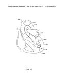 MEDICAL GUIDEWIRE diagram and image