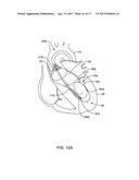 MEDICAL GUIDEWIRE diagram and image