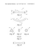 PERCUTANEOUS TRANSVALVULAR INTRAANNULAR BAND FOR MITRAL VALVE REPAIR diagram and image