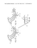 PERCUTANEOUS TRANSVALVULAR INTRAANNULAR BAND FOR MITRAL VALVE REPAIR diagram and image