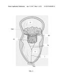 APPARATUS AND METHODS FOR DELIVERY OF TRANSCATHETER PROSTHETIC VALVES diagram and image