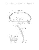 ACTIVELY-ENGAGEABLE MOVEMENT-RESTRICTION MECHANISM FOR USE WITH AN     ANNULOPLASTY STRUCTURE diagram and image