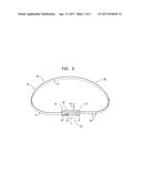 ACTIVELY-ENGAGEABLE MOVEMENT-RESTRICTION MECHANISM FOR USE WITH AN     ANNULOPLASTY STRUCTURE diagram and image