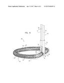 ACTIVELY-ENGAGEABLE MOVEMENT-RESTRICTION MECHANISM FOR USE WITH AN     ANNULOPLASTY STRUCTURE diagram and image