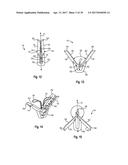 DELIVERY CATHETER HANDLE AND METHODS OF USE diagram and image