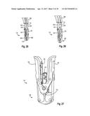 DELIVERY CATHETER HANDLE AND METHODS OF USE diagram and image