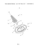 SYSTEM AND METHOD FOR REPAIRING ARTICULAR SURFACES diagram and image