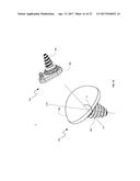 SYSTEM AND METHOD FOR REPAIRING ARTICULAR SURFACES diagram and image