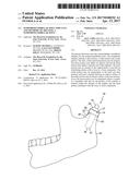 TEMPOROMANDIBULAR JOINT IMPLANTS AND METHODS OF TREATING A     TEMPOROMANDIBULAR JOINT diagram and image