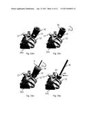 DESIGN OF AN IMPLANT FOR CARTILAGE REPAIR diagram and image