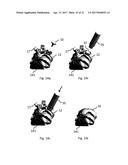 DESIGN OF AN IMPLANT FOR CARTILAGE REPAIR diagram and image