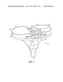 ANTERIOR LOCKING CLIP diagram and image