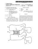 EXPANDABLE FUSION DEVICE AND METHOD OF INSTALLATION THEREOF diagram and image