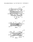 EXPANDABLE FUSION DEVICE AND METHOD OF INSTALLATION THEREOF diagram and image