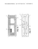 EXPANDABLE FUSION DEVICE AND METHOD OF INSTALLATION THEREOF diagram and image