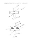 Methods and Apparatuses for Vertebral Body Distraction and Fusion     Employing a Coaxial Screw Gear Sleeve Mechanism diagram and image