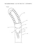 SPINAL IMPLANTS AND RELATED INSTRUMENTS AND METHODS diagram and image