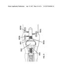 INSERTION TOOL FOR IMPLANT AND METHODS OF USE diagram and image