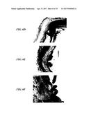 STENTS HAVING PROTRUDING DRUG-DELIVERY FEATURES AND ASSOCIATED SYSTEMS AND     METHODS diagram and image