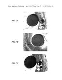 STENTS HAVING PROTRUDING DRUG-DELIVERY FEATURES AND ASSOCIATED SYSTEMS AND     METHODS diagram and image