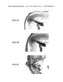 STENTS HAVING PROTRUDING DRUG-DELIVERY FEATURES AND ASSOCIATED SYSTEMS AND     METHODS diagram and image