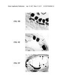 STENTS HAVING PROTRUDING DRUG-DELIVERY FEATURES AND ASSOCIATED SYSTEMS AND     METHODS diagram and image