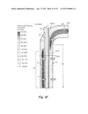 FLUID CHANNEL FLOW DISRUPTION diagram and image