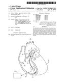 INTRACARDIAC MEDICAL DEVICE WITH PRESSURE SENSING diagram and image