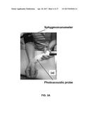 PHOTOACOUSTIC FLOWMETRY SYSTEMS AND METHODS diagram and image