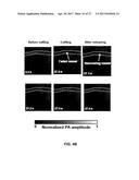 PHOTOACOUSTIC FLOWMETRY SYSTEMS AND METHODS diagram and image