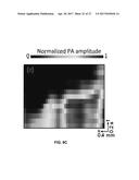 PHOTOACOUSTIC FLOWMETRY SYSTEMS AND METHODS diagram and image